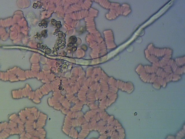 Obraz krwi pod mikroskopem. Widać krwinki oraz kawałki brudu na szkiełku. 