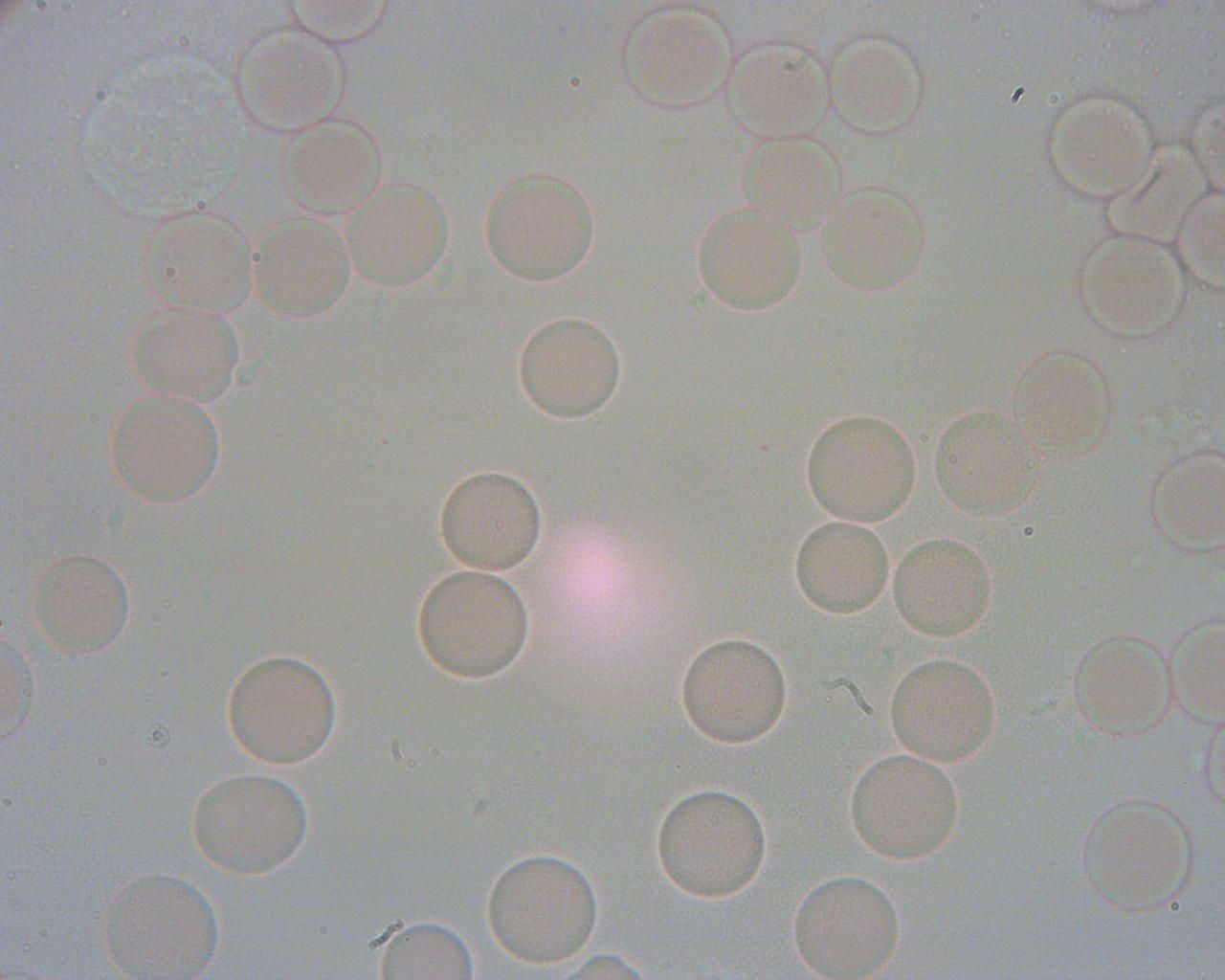 Obraz spod mikroskopu. Widać wolno pływające krwinki czerwone. Są okrągłe. 