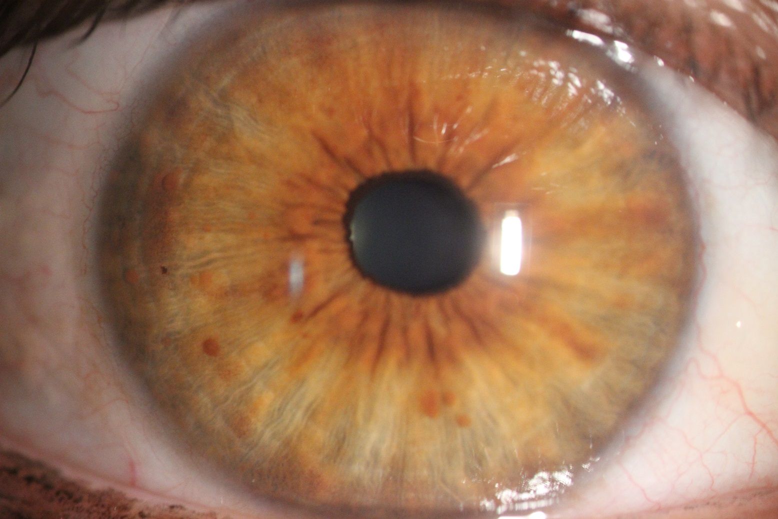 Tęczówka oka koloru brązowego z małą czarną źrenicą. 