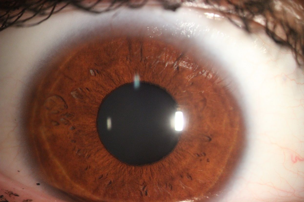 Zdjęcie tęczówki oka kolor brązowy.