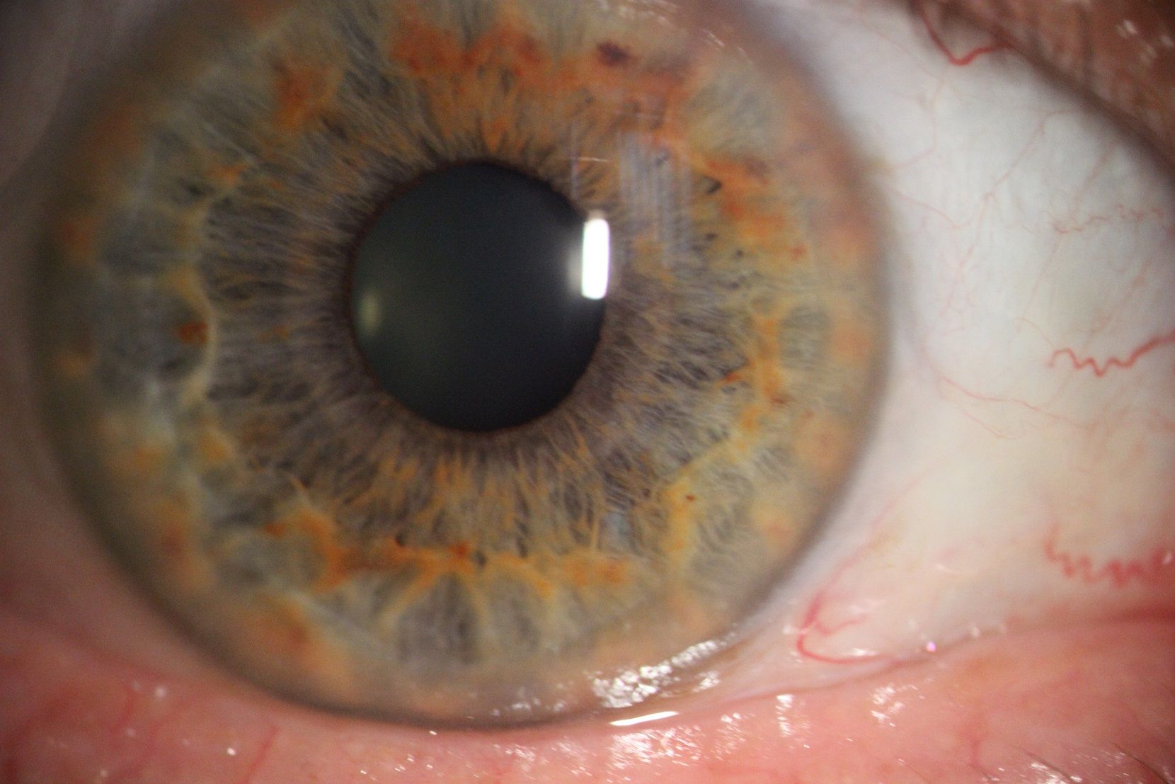 Zdjęcie tęczówki oka kolor mieszany