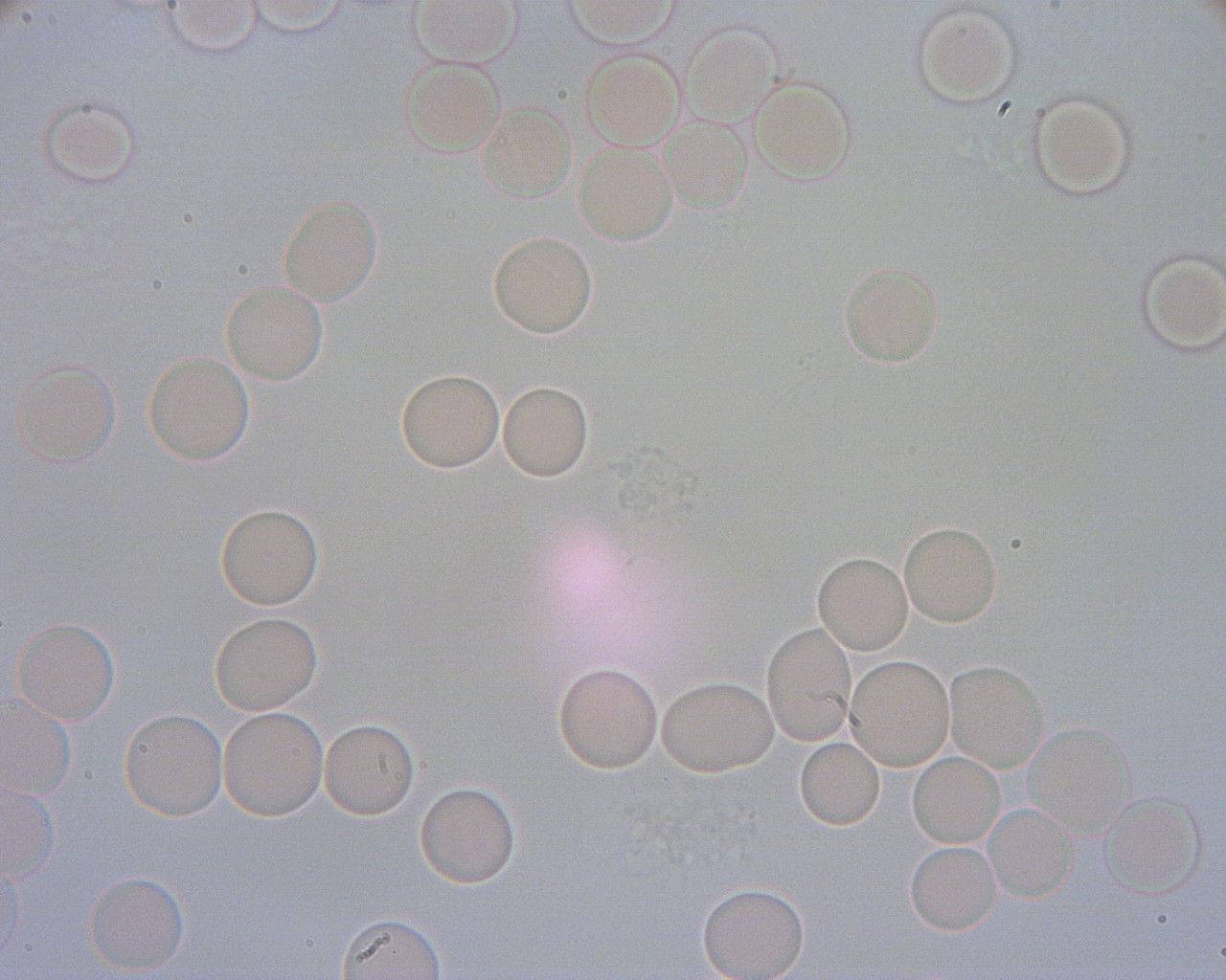 Prawidłowy obraz krwi pod mikroskopem. Widać rozklejone erytrocyty