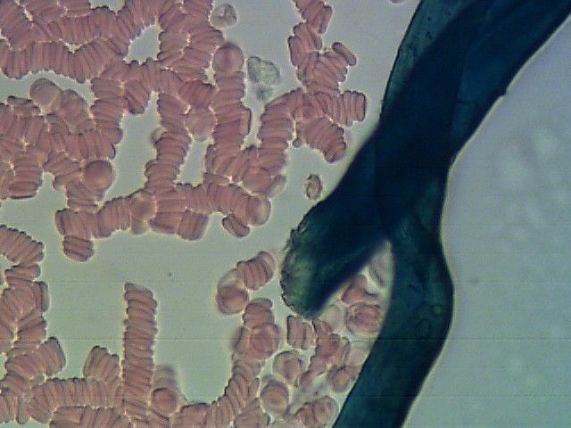 Krew pod mikroskopem. Widać czarną niteczkę i erytrocyty