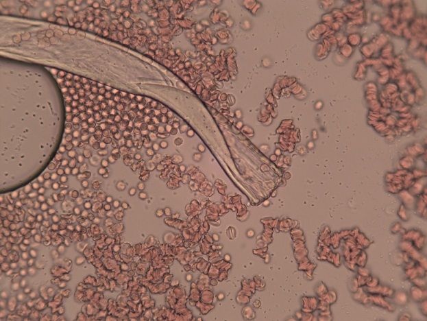 Obraz krwi pod mikroskopem, Widać krwinki, kawałek niteczki i bąbelek powietrza